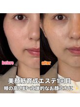 リエル(RIEL)/【美顔筋育成】