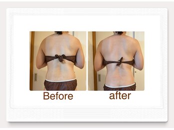 ルル リラクゼーション(RURU Relaxation)/ダイエット/ボティライン