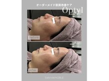 サロン ド ノーブル(salon de NOBLE)の雰囲気（ラッシュリフト/まつ毛パーマ/まつぱ/高濃度トリートメント）