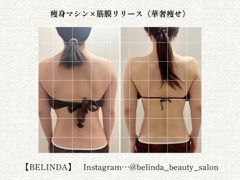 ベリンダ 中崎町店(BELINDA)の写真/【高パワーで人気のマシン・オールハンド筋膜】続けやすい痩身ケア◎見た目の変化をもっと楽しむために☆