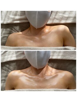 ロハス(LOHAS)/歪みを整える