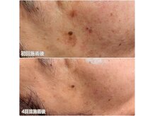 ビテラスの雰囲気（フェイシャルもおすすめです！）