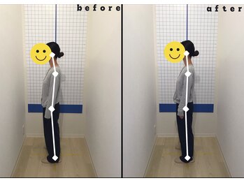 今津ぴっと骨盤整体院/20代 女性 整体・矯正・体幹