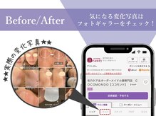 ココモンド(COCOMONDO)の雰囲気（≪体験された方の写真≫毛穴/小顔/たるみ改善/エステ/シミケア）