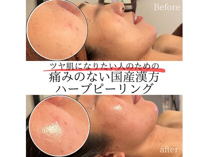 シャラ(shara)の写真