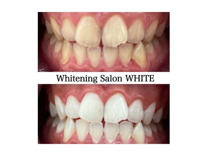 ホワイトニングサロン ホワイト 津山店(WHITE)の写真
