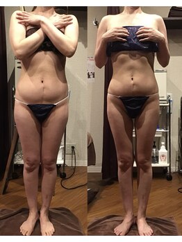 エスプレッソ(espresso,)/【全身痩身】で産後ダイエットも