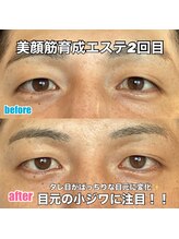 リエル(RIEL)/【美顔筋育成】