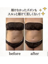 ヨサパーク シアー(YOSA PARK sheer)/諦めていたお腹・・・