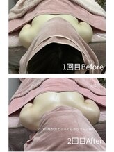 チュラ 大宮店(Chura)/【30代】バストアップ2回目@大宮