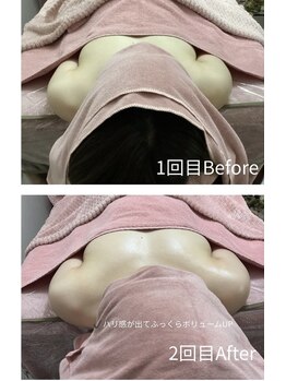 チュラ 大宮店(Chura)/【30代】バストアップ2回目@大宮