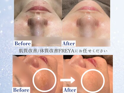 フレイヤ(FREYA)の写真