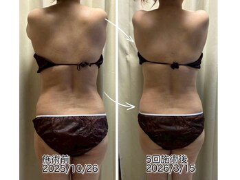 クールスパ(COOL SPA)/【100カップチャレンジ経過】