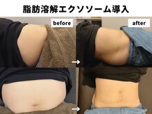 sleep monster｜バクの隠れ家【4/1 NEW OPEN（予定）】/