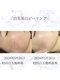 サロン ド メデューズ 札幌店(Salon de meduse)の写真/すみを解消してパッと明るい表情へ◇本格ピーリングと肌管理で、透き通るような白玉美肌に！