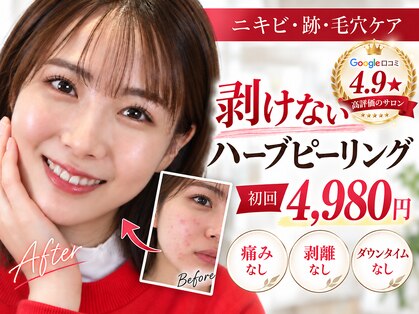 肌レボ 高田馬場店(肌REVO)の写真