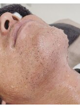 カルディエ(Cardie)/ポップアップ現象