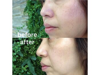 イントゥカージョ(into Kajo)/５０代☆スキンケア２か月後の肌