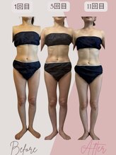 アールハーブデトックス(AR HERB DETOX)/何より見た目に変化が◎