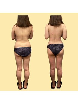 琥珀 アザブ(AZABU)/最短で変わりたいなら。。。