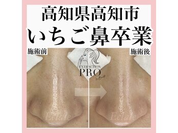 エクラーレ(Eclale)/【毛穴ケア】症例