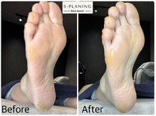 レーヴ アヴニール(Reve Avenir)/S-PLANING韓国式足裏角質ケア