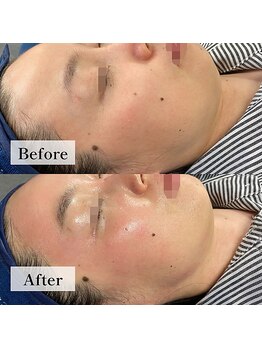 フローラル ビューティー(Floral-Beauty)/韓国最新フェイシャル☆エステ