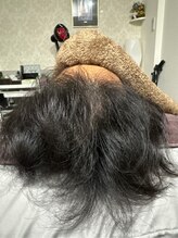 セントラル鍼灸院リラクシー(Re:laxy)