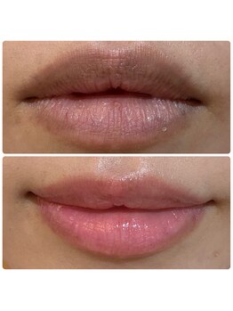 チョチョワンプラス(緒々one+)/染めないのにピンク？