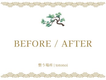 トトノイ(totonoi)/施術前／施術後