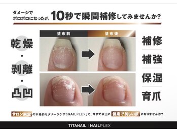 コセイ 千葉中央(kosei.)の写真/お爪の瞬間集中補修液ずっと無料◎補修、補強、保湿をして育爪まで導く、理想のネイル空間♪