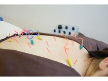 アンドコンディショニングルーム(&conditioning room)/根深いコリには【電気】も！