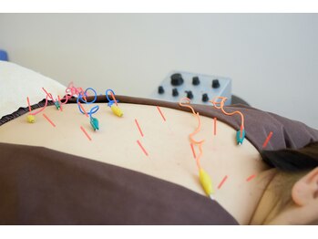 アンドコンディショニングルーム(&conditioning room)/根深いコリには【電気】も！