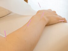 トーリ 代官山(taulli)/肩こり解消の鍼【代官山/鍼灸】