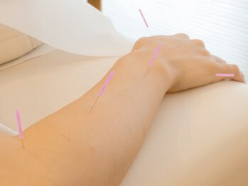 トーリ 代官山(taulli)/肩こり解消の鍼【代官山/鍼灸】