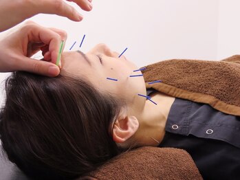 スミ(sumi.)/《施術》美容鍼