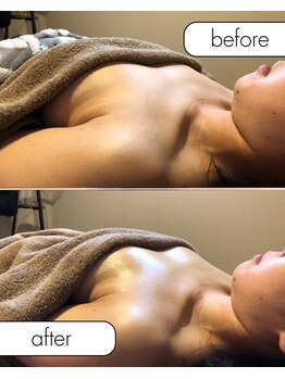 レーヴ(Reve)/ベルバスト90分（全身）