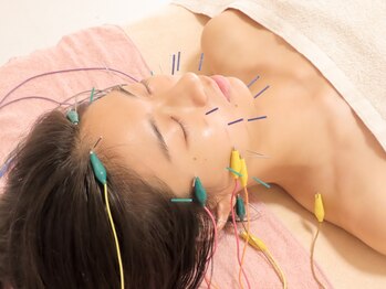 ヨンビの写真/美容鍼/美容骨格調整を組み合わせた貴方のお悩みを改善するオーダーメイド施術![吉祥寺/美容鍼]