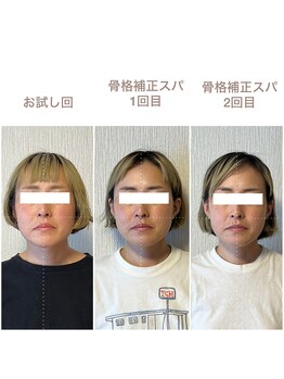 紡(TSUMUGU)/骨格補正ドライスパ(２回目)