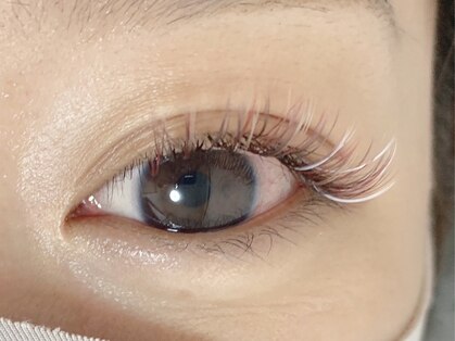 シルム(silm)の写真