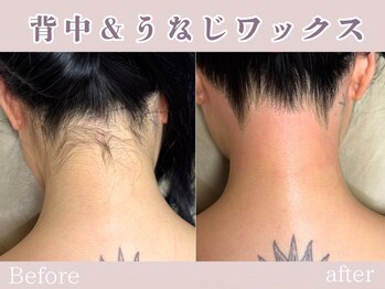 レッド(RED)/背中＆うなじワックス