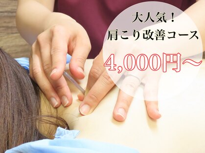 わきさか鍼灸整骨院・鍼灸院 レーヴ(Reve)の写真