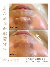 デイズ(day’s)/筋膜ケアで小顔リフトアップ