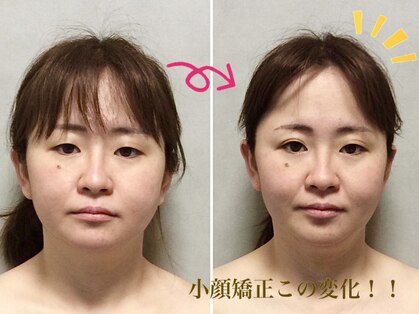美容整体ウェリナ 名駅院の写真
