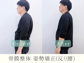 ヒラメント 大森(Hilament)/姿勢矯正整体ビフォーアフター