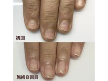 ポノポ(ponopo)の雰囲気(人前に手を出すのが恥ずかしかった、50代 K様)