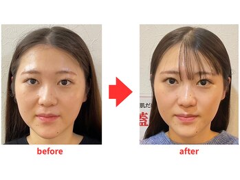 ブプラ 小倉店(BUPURA)/