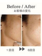 ココプレジール(Cocoplaisir)/バクテリウムピール/乾燥/シミ