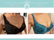 美人バスト 新潟店/ 【バストアップ★育乳】症例