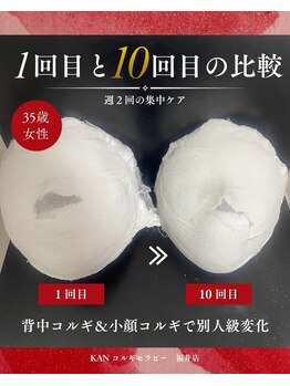 KANコルギセラピー 福井店の写真/結果重視の韓国式小顔コルギ専門店♪1回の施術で効果を実感◎5回目の施術で周囲から「痩せたね！」の声続出